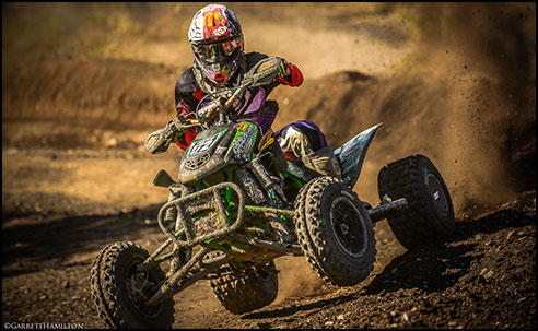 MX 101